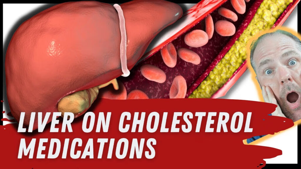 Medical case study showing cholesterol medication risks and liver damage with lab results comparison.