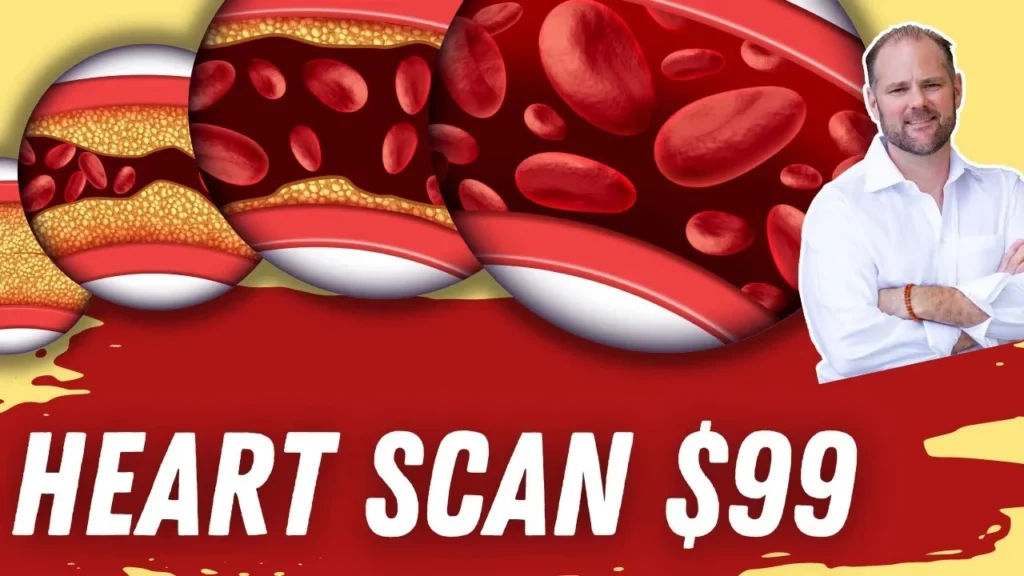 Heart Scan Calcium Scoring Promotion - $99 Cardiovascular Risk Assessment Marketing