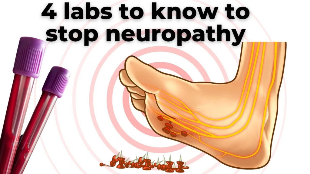 Infographic listing the 4 essential lab tests for diagnosing and treating neuropathy: mold, fasting insulin, C-reactive protein, and homocysteine.