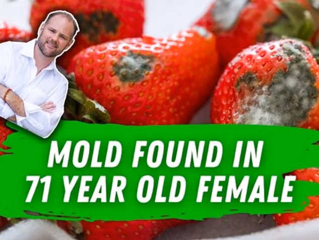 Mold infection test results showing high gliotoxin levels in 71-year-old female patient