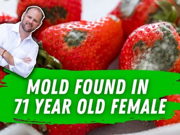 Mold infection test results showing high gliotoxin levels in 71-year-old female patient
