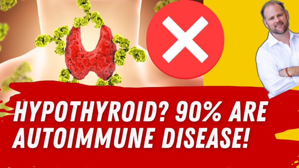 Infographic stating 90% of hypothyroidism cases are autoimmune Hashimoto's disease, not just low thyroid function.
