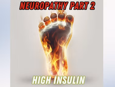 Diagram of foot neuropathy nerve damage and high insulin effects on nervous system.