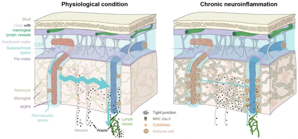 Diagram comparing healthy brain lymphatic drainage versus chronic neuroinflammation, showing how waste clearance is impaired