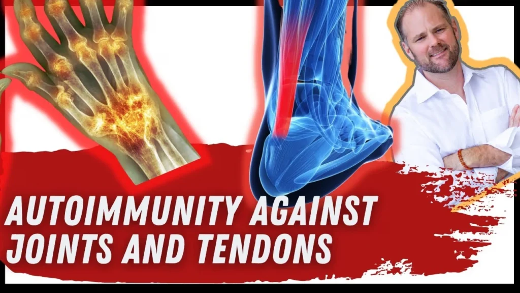 Illustration showing autoimmune antibodies attacking collagen in joint and tendon tissues, causing inflammation.