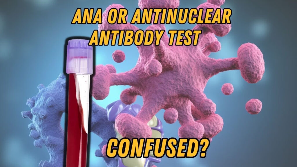 Header graphic questioning ANA test confusion with antinuclear antibody explanation.