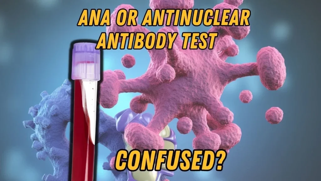 Header graphic questioning ANA test confusion with antinuclear antibody explanation.