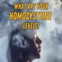 Dangerously high homocysteine lab result of 44.6 umol/L showing severe elevation above normal range.