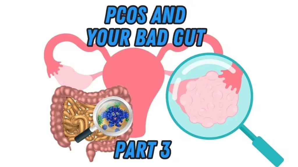 The PCOS and gut connection, showing a magnified view of gut bacteria and an ovary with a cyst.