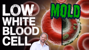 Infographic on how hidden toxins like mold, heavy metals, and pollutants cause low white blood cell count, featuring a case study and a 3-step healing plan.