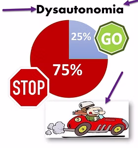 pie chart with 75% stop and 25% go on dysautonomia