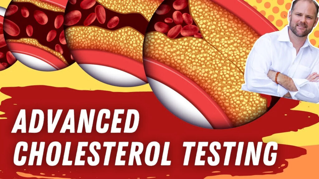 Advanced Cholesterol Testing - Small vs Large LDL Particle Size Heart Risk