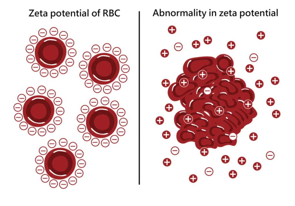 Diagram showing how abnormalities in red blood cell zeta potential (surface charge) can cause unhealthy clumping instead of normal repulsion.
