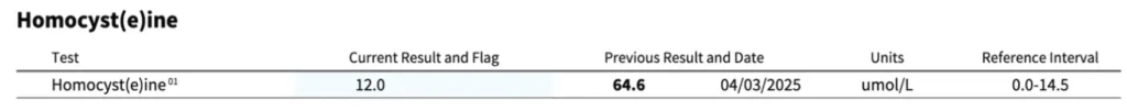 Laboratory test result showing homocysteine level of 12.0 umol/L, which falls within the normal reference interval of 0.0-14.5 umol/L.