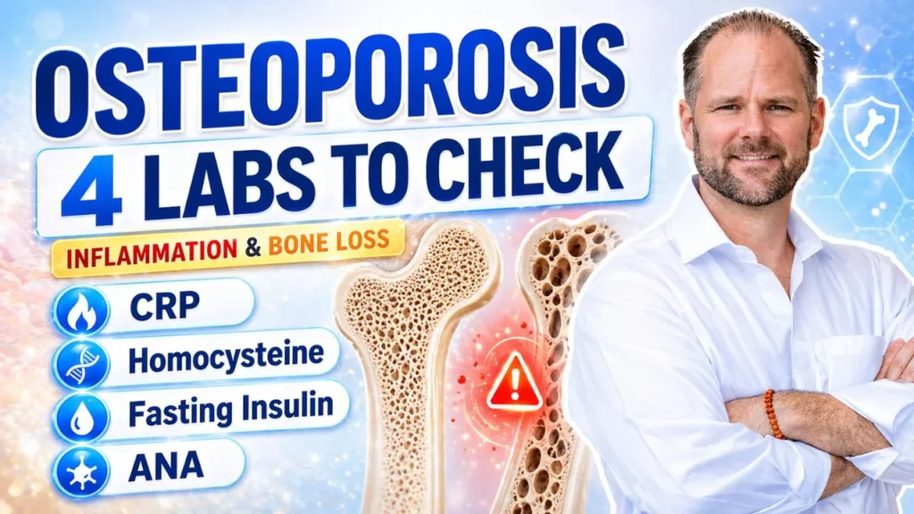 Thumbnail showing osteoporosis, inflammation, bone loss, and 4 important lab tests to check including CRP, homocysteine, fasting insulin, and ANA with Dr. Hugh from a functional medicine perspective.